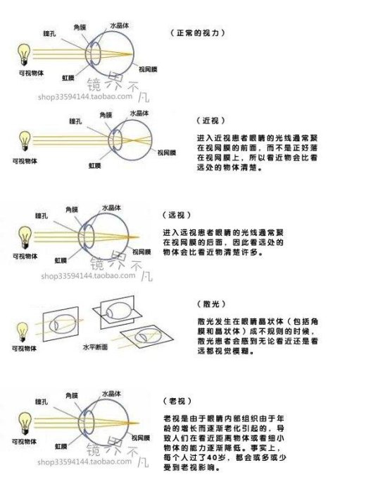 近视眼怎么慢慢恢复视力(图1)
