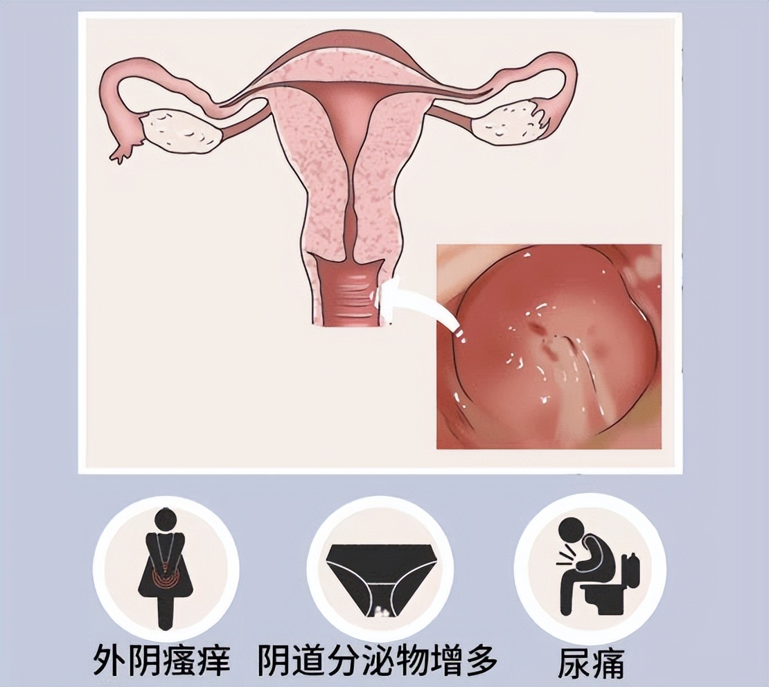 女人喝益生菌能减肥吗(图1)