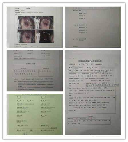 hpv是艾滋病吗_HPV与艾滋病傻傻分不清？(图4)