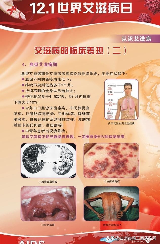 艾滋病的潜伏期是多少时间(图1)