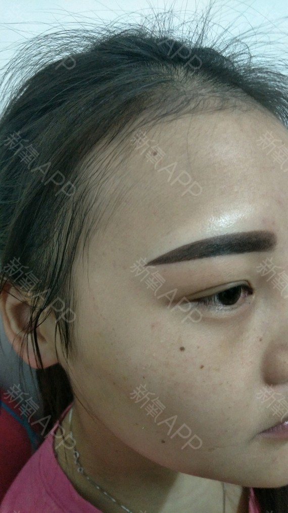 纹眉对身体有多大的伤害_纹眉美丽背后的潜在风险(图4)