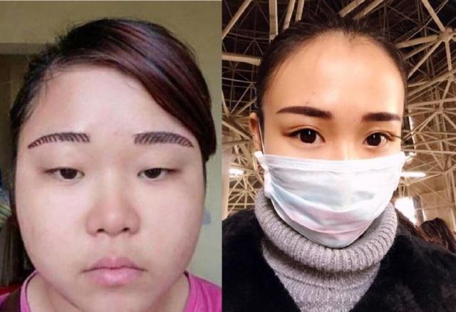 纹眉对身体有多大的伤害_纹眉美丽背后的潜在风险(图5)