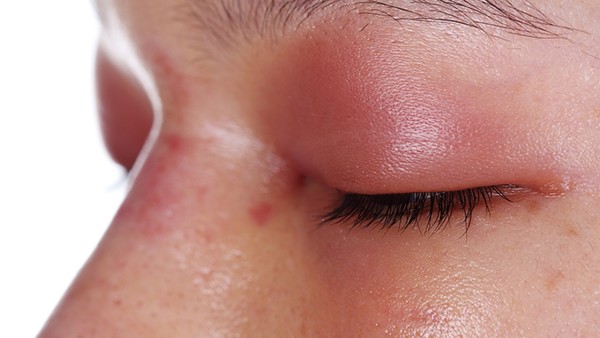 种植口罩&透明质酸注射(图1) 种植口罩&透明质酸注射(图1)