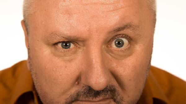 眼袋重是什么原因造成的(图2) 眼袋重是什么原因造成的(图2)