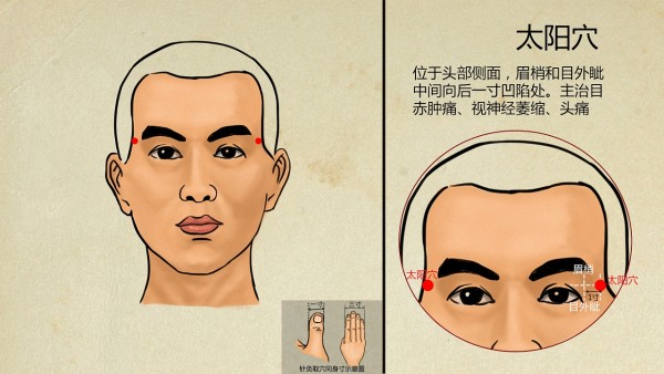怎样填充太阳穴安全(图1) 怎样填充太阳穴安全(图1)
