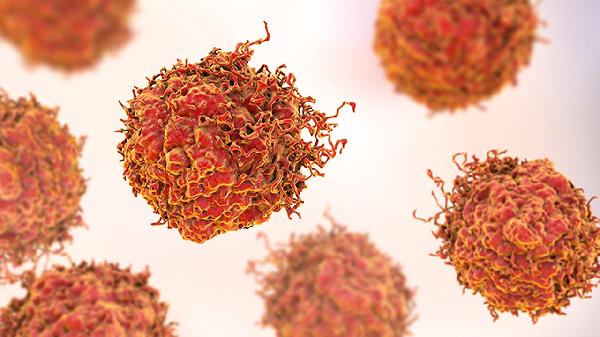 岩斜区肿瘤危机:不手术治疗的隐患与风险解析!(图1) 岩斜区肿瘤危机:不手术治疗的隐患与风险解析!(图1)