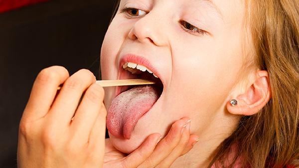 舌头上白白的是积食了吗(图1)