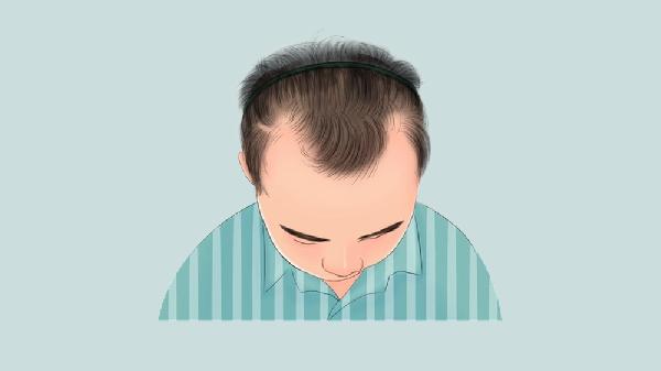 选择隔离霜的方法(图1)
