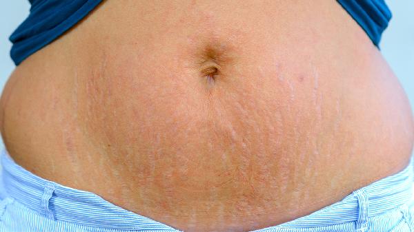 有宝妈用过美腹邦吗?效果怎么样(图1) 有宝妈用过美腹邦吗?效果怎么样(图1)