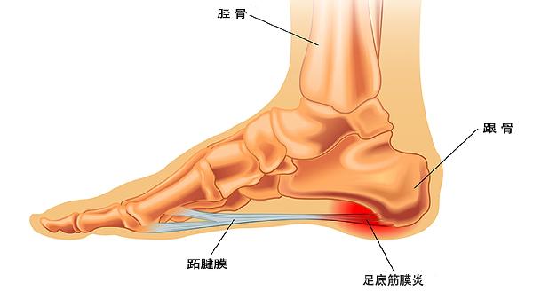 脚底烧灼感摸着又不热是什么情况(图2)