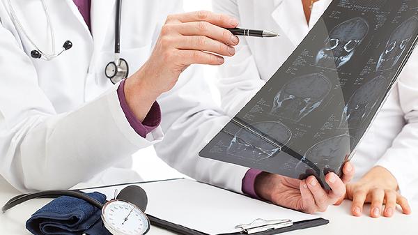 左脑有时疼左脸腮帮子麻白眼球发蓝(图2)