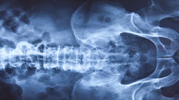 食管裂孔疝需要做哪些检查(图1) 食管裂孔疝需要做哪些检查(图1)