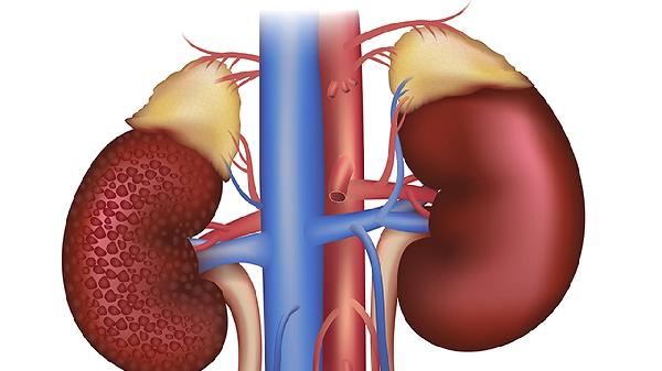 四维肾缺如有翻盘的吗(图1) 四维肾缺如有翻盘的吗(图1)