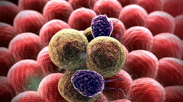 被蚊虫叮咬嗜酸性粒细胞(图2)