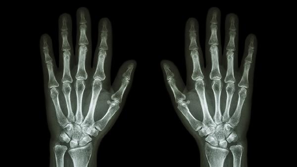 镉超标对人体的危害(图2)