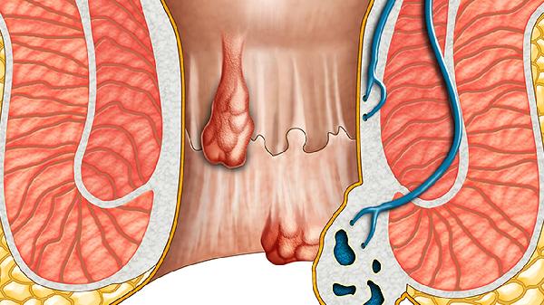 高钾血症酸中毒的原因(图1) 高钾血症酸中毒的原因(图1)
