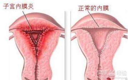 更年期的女人有什么症状表现(图2)