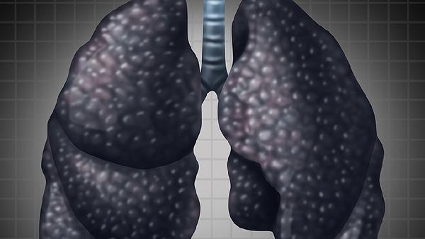 气管腺样囊性癌存活率(图1)