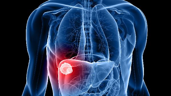 治疗肝损伤的食物(图1) 治疗肝损伤的食物(图1)