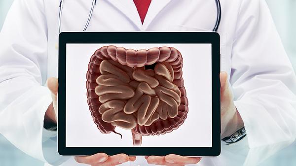 肠息肉术后多久可以正常吃饭(图1) 肠息肉术后多久可以正常吃饭(图1)