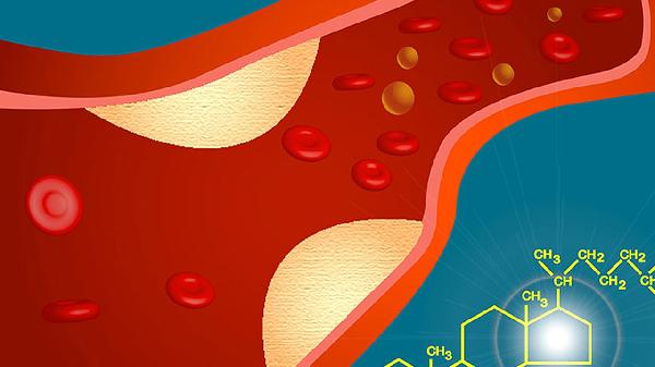 肾动脉狭窄能做手术吗?能治好吗(图2) 肾动脉狭窄能做手术吗?能治好吗(图2)