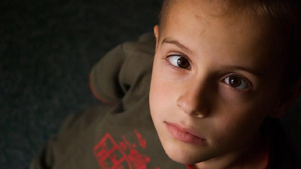 婴儿脸上长湿疹怎么办(图2) 婴儿脸上长湿疹怎么办(图2)