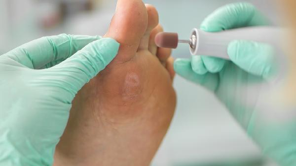 18岁后扁平足还能矫正吗(图1) 18岁后扁平足还能矫正吗(图1)