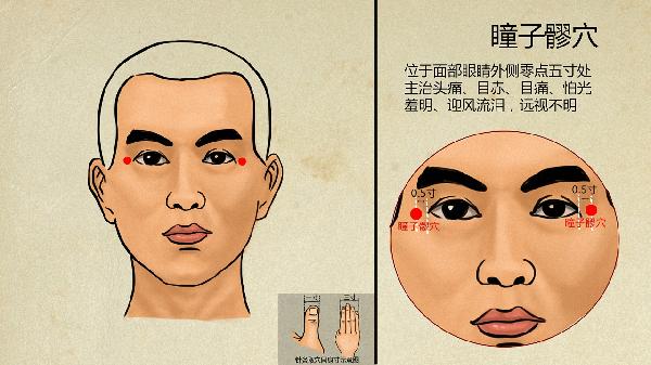 梨状肌综合征的最佳治疗方法穴位(图3)