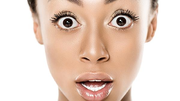 切除法去眼袋会出现眼睑外翻吗(图2) 切除法去眼袋会出现眼睑外翻吗(图2)