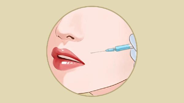 做去鼻唇沟禁忌人群及适宜人群有哪些？(图3)