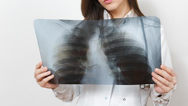 新生儿肺动脉高压的治疗方法有哪些呢(图2)
