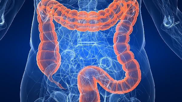 结肠癌早期症状腹痛是哪个位置(图3)