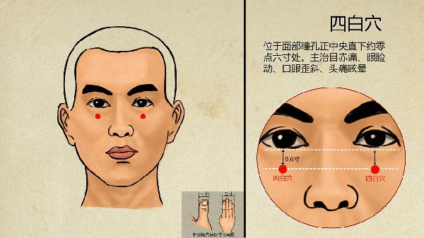 精神分裂症的中医治疗方法有哪些(图3)
