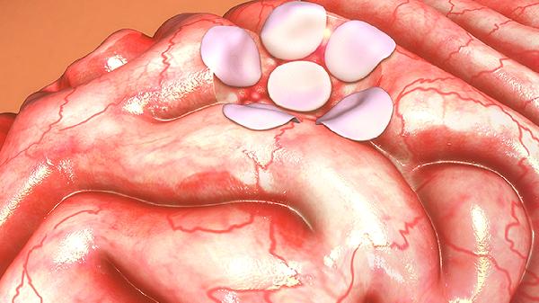 排宿便清肠道有什么方法?(图1) 排宿便清肠道有什么方法?(图1)