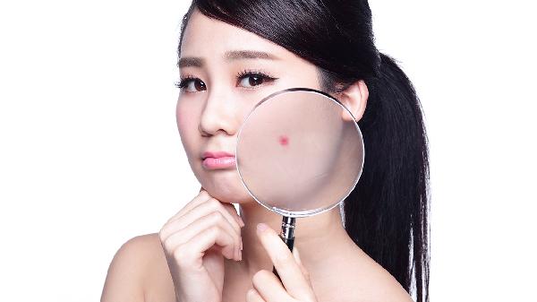 脸上斑越来越多了什么原因(图2)