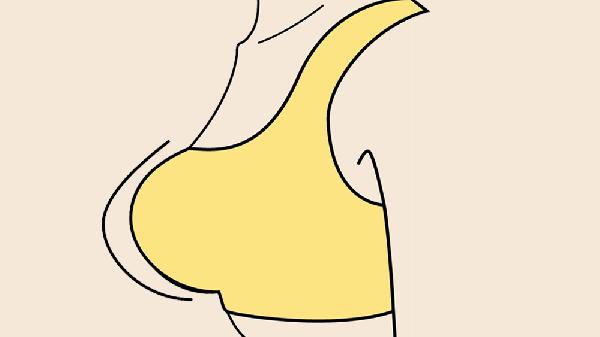乳房4c类是中期还是晚期(图1)