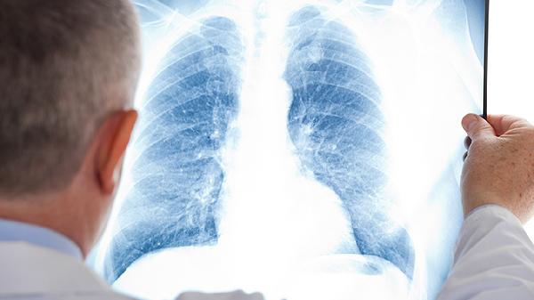 大人38度能自行退烧吗?(图1)