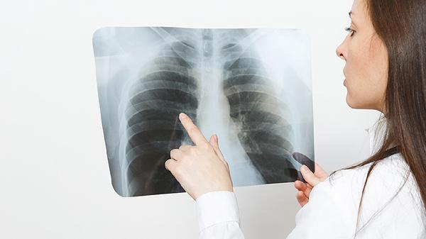 非特异性肋软骨炎治疗效果不佳的方法为(图3)