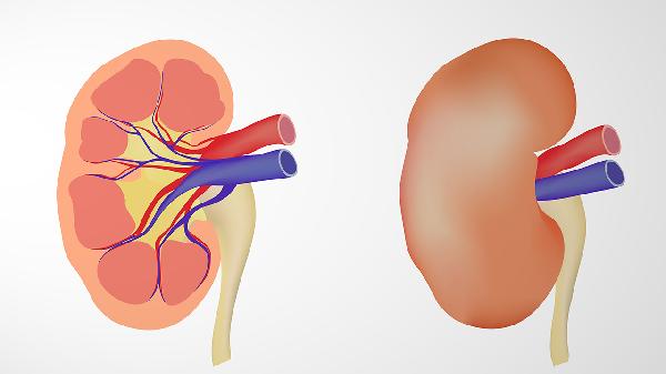 肾囊肿平时不能吃什么食物(图1)