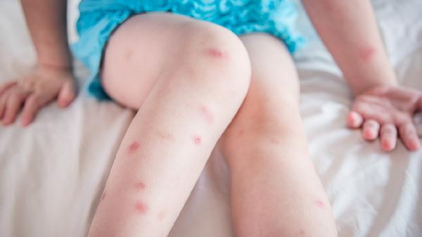 胸口右上方隐痛怎么回事?(图2)