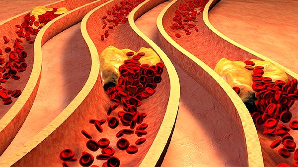 淋巴细胞百分比偏低是什么意思?(图1)