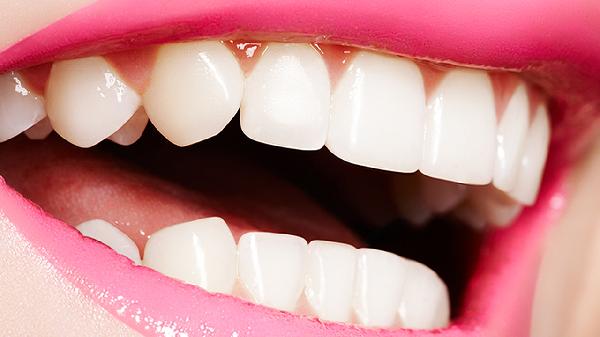 牙齿美白价格大概多少左右(图3)
