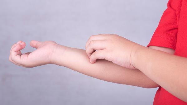 单纯疱疹病毒抗体igg阳性?(图1)