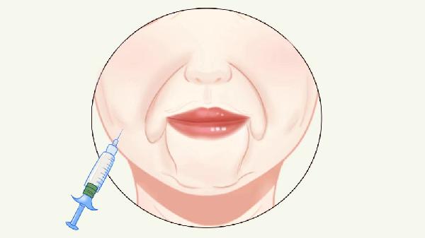 除皱针的价格一般是多少国产(图3) 除皱针的价格一般是多少国产(图3)
