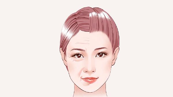 做眼睑松弛修复有哪些护理方法(图1)