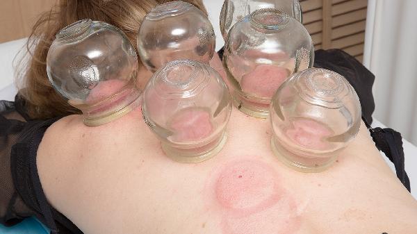 身上皮肤有白点是什么原因(图2) 身上皮肤有白点是什么原因(图2)