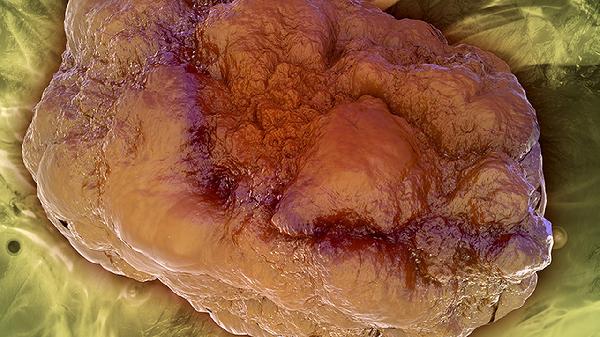 肿瘤标志物12项指标如果超出正常范围(图2) 肿瘤标志物12项指标如果超出正常范围(图2)