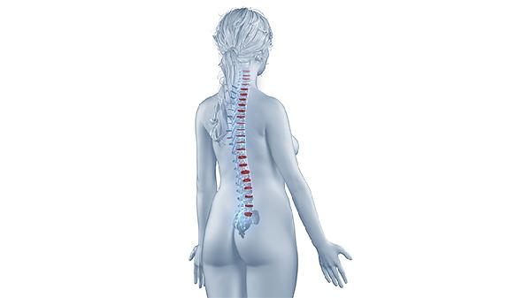 强直性脊柱炎应该要怎么治疗(图2)