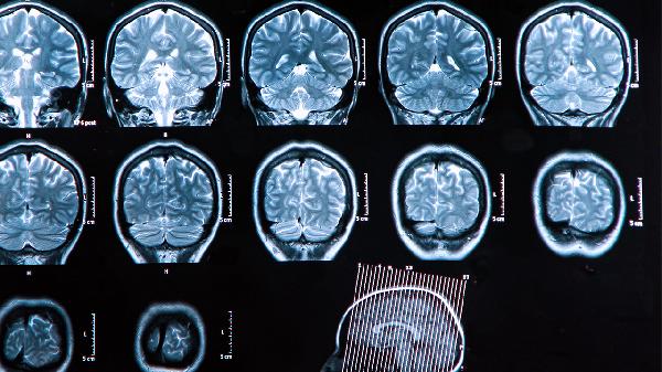 家用盆底肌修复仪器有用吗(图1)