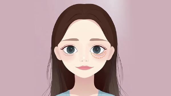 胶原蛋白填充做卧蚕做完要多久时间？(图1)